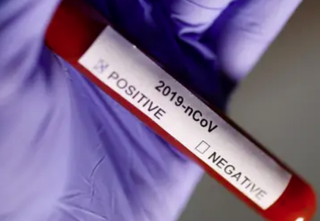 Lee más sobre el artículo EL SUBSECRETARIO LÓPEZ -GATELL, ASEGURA QUE MEXICO DEBE APRENDER A CONVIVIR CON AGENTES INFECCIOSOS