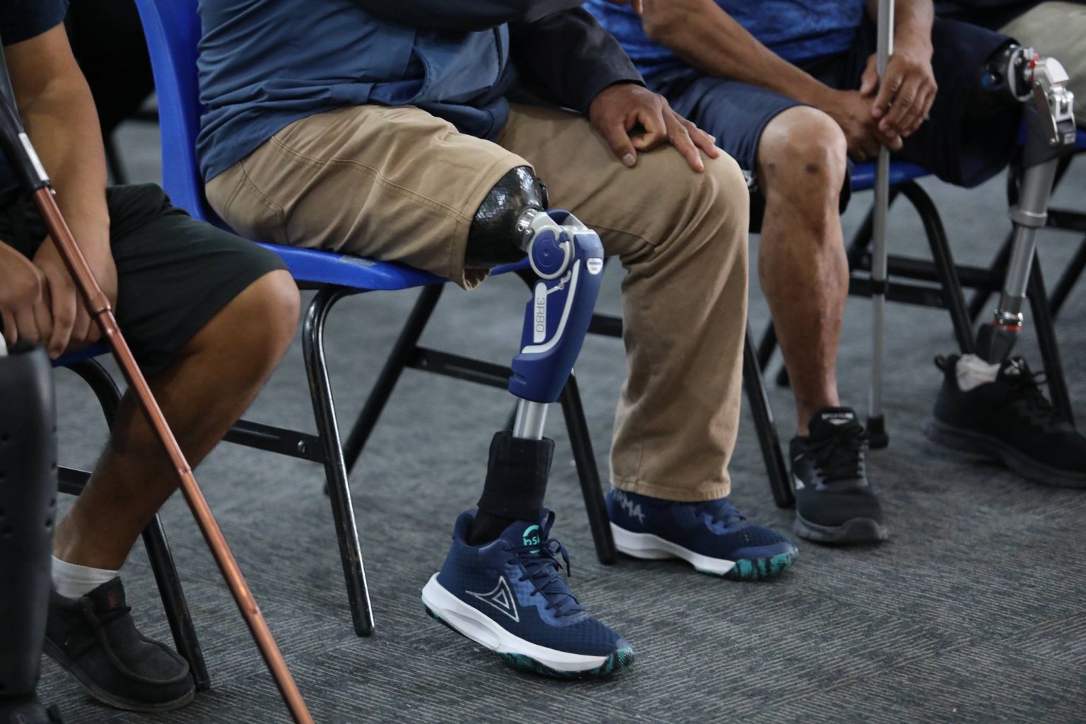 Lee más sobre el artículo Entrega SEDIF 17 prótesis para fortalecer la inclusión