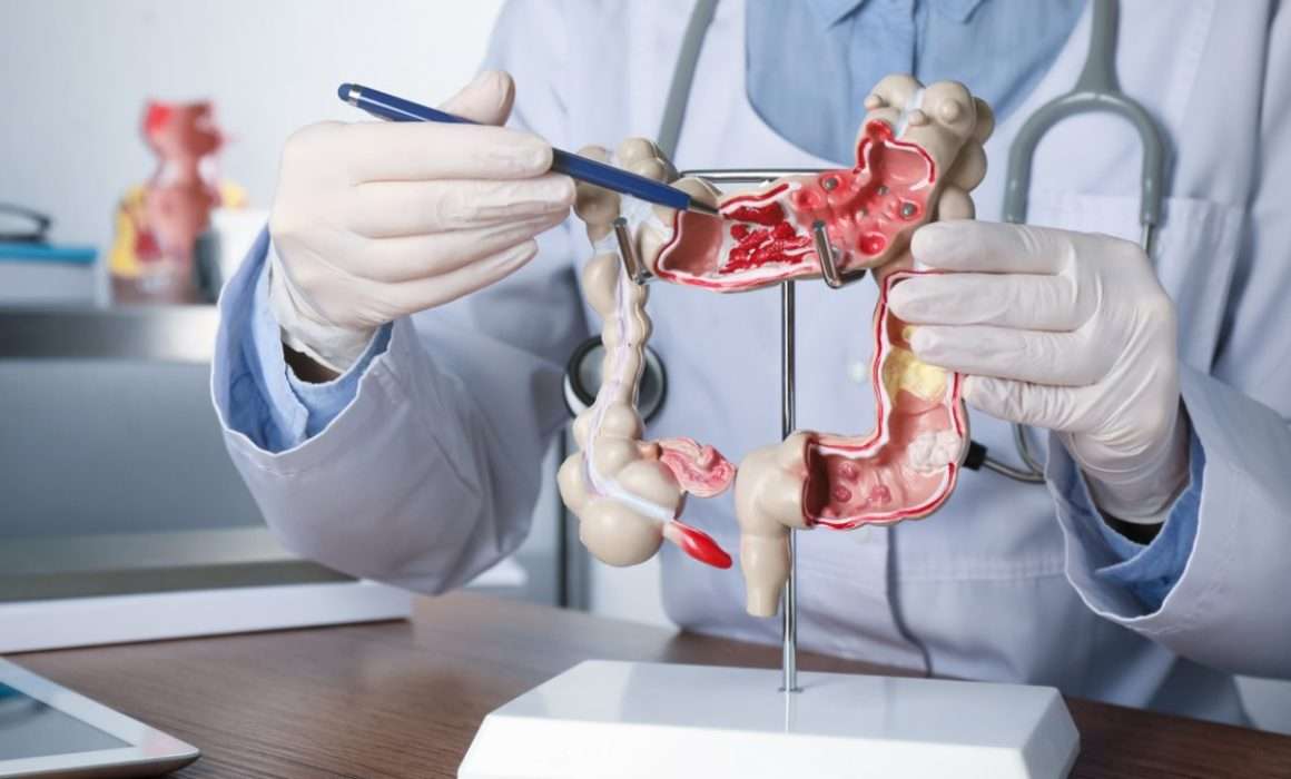 Lee más sobre el artículo IMSS Querétaro llama a detectar a tiempo cáncer de colon