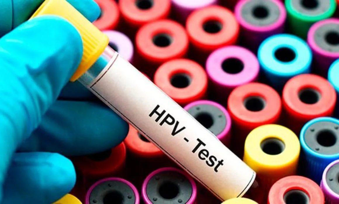 Lee más sobre el artículo VPH: una infección frecuente relacionada con varios tipos de cáncer